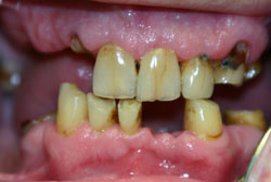 �� �������