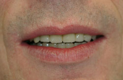 ������� ��� �������� ����� �������