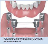 �������� �����������