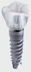 ���������� MIS