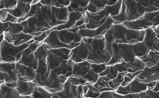 ����������� OSSEOTITE ��� ����������� 20 000�