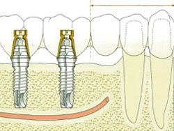 ����������� �����