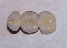 ������������������� �������