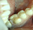 ��������� �������