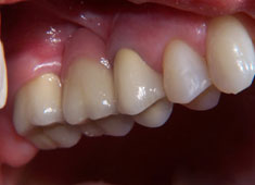 ������������������� �������