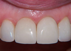 ������������ �������