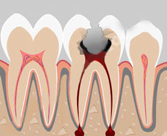 ������ - ������� ��������